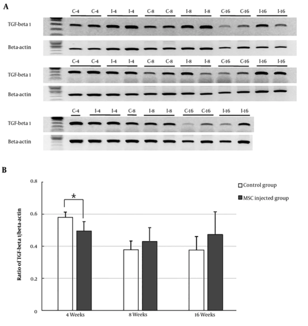Reverse transcription-polymerase chain reaction (RT-PCR) analysis of transforming growth factor- β1 (TGF-β1) mRNA expression. A, Penile tissues from rats treated with the stem cells for 4, 8, or 16 weeks were collected and the expression of TGF-β1 was analyzed by RT-PCR. (I; stem cell injected groups and C; control groups). B, Graphs showing changes in the ratio of TGF-β1/ β-actin in the tissues. All data represent means ± standard error from six rats from each group as a function of time. <sup>*</sup>, P < 0.01, different from the control group in one-way ANOVA analysis. A two-way ANOVA between time and treatment indicated P < 0.05. Reverse transcription-polymerase chain reaction (RT-PCR) analysis of transforming growth factor- β1 (TGF-β1) mRNA expression. A, Penile tissues from rats treated with the stem cells for 4, 8, or 16 weeks were collected and the expression of TGF-β1 was analyzed by RT-PCR. (I; stem cell injected groups and C; control groups). B, Graphs showing changes in the ratio of TGF-β1/ β-actin in the tissues. All data represent means ± standard error from six rats from each group as a function of time. <sup>*</sup>, P < 0.01, different from the control group in one-way ANOVA analysis. A two-way ANOVA between time and treatment indicated P < 0.05.