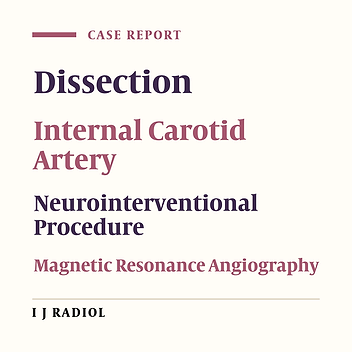 Dissection of Extracranial Internal Carotid Artery Due to Balloon Guiding Catheter Resulting in Asymptomatic Internal Carotid Artery Occlusion
