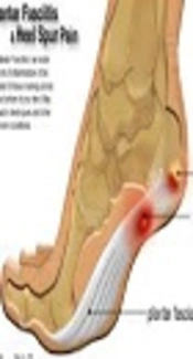 Intra- and Inter-Rater Reliability of Ultrasound in Plantar Fascia Thickness Measurement