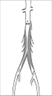 Cover image of the article: Two-Year Primary Patency Rates After Aortoiliac Occlusive Disease Endovascular Treatment