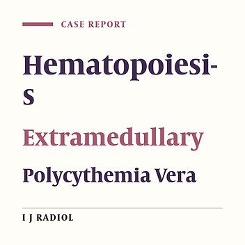 Paraspinal and Presacral Extramedullary Hematopoiesis: A Rare Manifestation of Polycythemia Vera