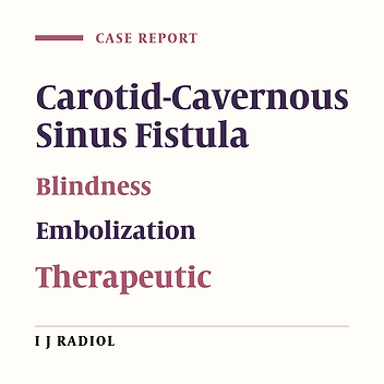 Unilateral Blindness as the Only Finding in a Patient with High Flow Carotid-Cavernous Fistula