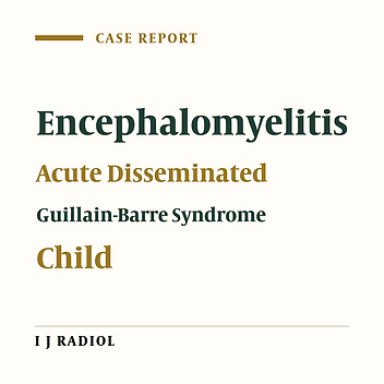 Acute Combined Demyelination of CNS and PNS: A Case Report