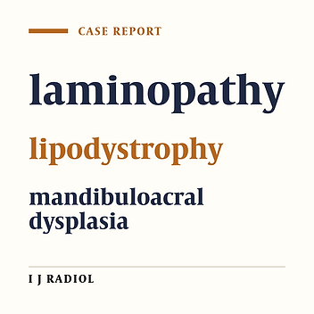 Mandibuloacral Dysplasia in An Iranian Girl