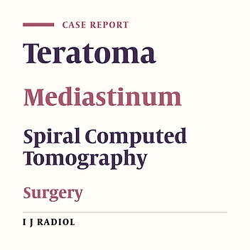 Mature Teratoma of the Posterior Mediastinum: A Case Report