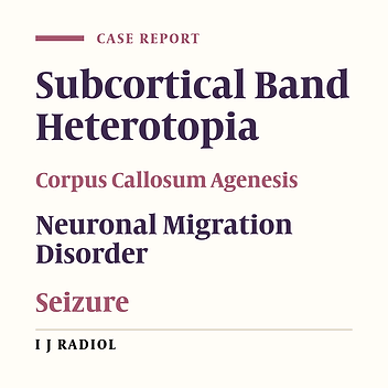 Neuronal Migration Disorder; A Case Report of Subcortical Band Heterotopia Associated with Corpus Callosum Agenesis