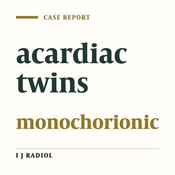 Acardiac Parabiotic Twin: A Case Report