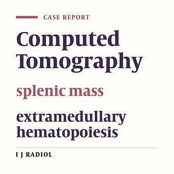 Large Splenic Mass of Extramedullary Hematopoiesis