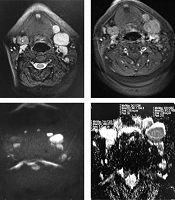 Iranian Journal of Radiology 