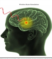 Cover image of the article: Neurobiophysics and Strategies in Neural Stimulation