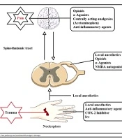 Cover image of the article: Pain Management After Total Knee Arthroplasty