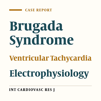 EP Testing in Asymptomatic Brugada Patients with Recurrent Palpitations. Just do it!