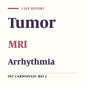A Large Cardiac Fibroma Lied in the Interventricular Septum of an Adult with Exertional Pain and Palpitation: A Case Report