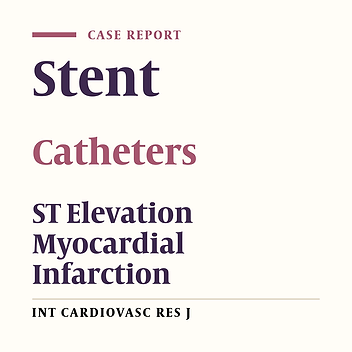 Coronary Perforation in a Patient with ST Elevation Myocardial Infarction Treated by Stent Graft Implantation Using the Double Guide Catheter (Ping Pong) Technique