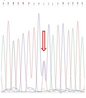 Genotyping of ARNTL and CLOCK Circadian Rhythm Gene Polymorphisms in Iranian Patients with Multiple Sclerosis