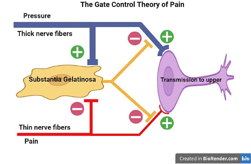 The gate control theory. We experience this phenomenon daily by applying rubbing or pressure to the injured area to relieve pain. The gate control theory. We experience this phenomenon daily by applying rubbing or pressure to the injured area to relieve pain.