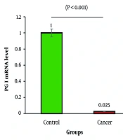 Reduced PG1 Gene Expression in Gastric Cancer Tissues: Implications for Early Diagnosis