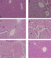 Protective Role of Protocatechuic Acid in Acetaminophen-Induced Hepatic Injury in Mice