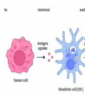 Dendritic Cell-Based Vaccines in Cancer Therapy: Focus on Melanoma, Glioblastoma, and Prostate Cancers
