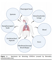 Reverse Transcription Polymerase Chain Reaction (RT-PCR) as a Tool for Severe Acute Respiratory Syndrome Coronavirus-2 (SARS-CoV-2) Surveillance in the Military