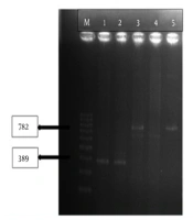 VIM, NDM, IMP, GES, SPM, GIM, SIM Metallobetalactamases in Carbapenem-Resistant Pseudomonas aeruginosa Isolates from a Turkish University Hospital