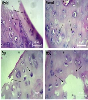 Comparing the Effects of Regular Aerobic Training, Hyaluronic Acid, and Mesenchymal Stem Cells on Wnt/β-Catenin Signaling of Cardiac Tissue in Rats with the Experimental Model of Knee Osteoarthritis