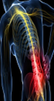 Lumbar Laminectomy: TIVA with Propofol Versus Inhalation Anesthesia with Isoflurane