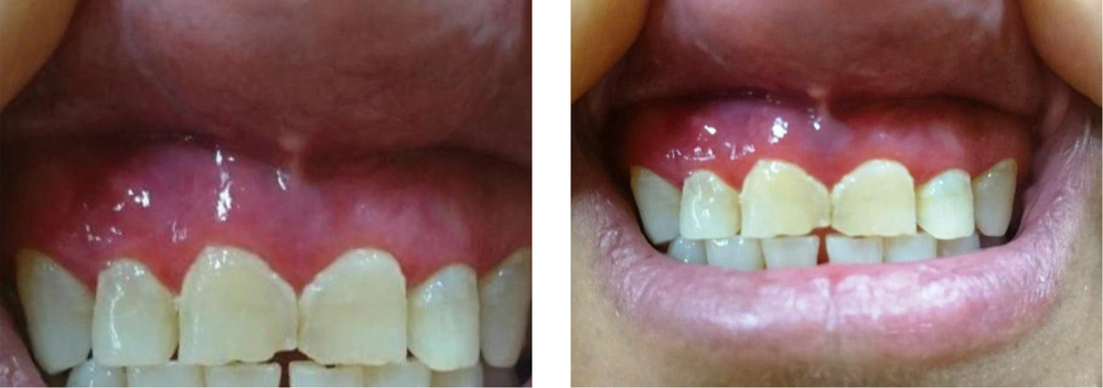 Clinical view of the patient Clinical view of the patient