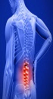 Investigating Relationship Between History and Physical Examination by Indicating MRI in Patients with Low Back Pain in Imam Reza Hospital