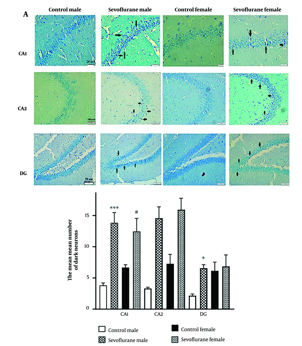 Production of dark neurons in the hippocampal CA1, CA2, and dentate gyrus in adult rats after repeated sevoflurane exposure in pre-adolescence. A, Light-microscopic appearance of toluidine blue-stained dark neurons in 10-μm hippocampus sections (CA1, CA2, and DG areas); B, Dark neuron numbers in CA1 and CA2 regions of the sevoflurane groups were significantly higher than in the control groups (P < 0.001 male sevoflurane vs. male control in CA1 and CA2 (#P < 0.05 female sevoflurane vs. female control in CA1 and CA2; P < 0.05 male sevoflurane vs. male control in DG region). All graphs are presented as mean ± SEM. Production of dark neurons in the hippocampal CA1, CA2, and dentate gyrus in adult rats after repeated sevoflurane exposure in pre-adolescence. A, Light-microscopic appearance of toluidine blue-stained dark neurons in 10-μm hippocampus sections (CA1, CA2, and DG areas); B, Dark neuron numbers in CA1 and CA2 regions of the sevoflurane groups were significantly higher than in the control groups (P < 0.001 male sevoflurane vs. male control in CA1 and CA2 (#P < 0.05 female sevoflurane vs. female control in CA1 and CA2; P < 0.05 male sevoflurane vs. male control in DG region). All graphs are presented as mean ± SEM.