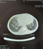 Hepatic Encephalopathy Linked to COVID-19 in a Pediatric Case: A Rare Presentation of COVID-19