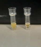 A Case of Hypertriglyceridemia in a Child 12 Years Old with Diabetic Ketoacidosis