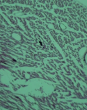 Palm Olein Oil Effect on the Heart Tissue of Male Rats