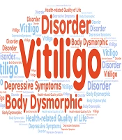 The Relationship Between Body Dysmorphic Disorder and Depressive Symptoms with Health-Related Quality of Life in Women with Vitiligo