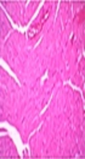 Cover image of the article: Weight Gain and Oxidative Stress in Midlife Lead to Pathological Concentric Cardiac Hypertrophy in Sedentary Rats