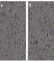 Pre and/or Neonatal Exposure to Bisphenol-A Exacerbates Experimental Parkinsonism