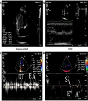 Ventricular Systolic and Diastolic Function and Vitamin D Levels: An Echocardiographic Study of Normal Coronary Patients