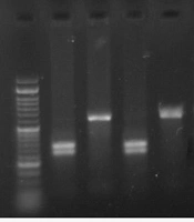 Programmed Cell Death 1 Gene Polymorphism as a Risk Factor for Systemic Lupus Erythematosus in Northwest Iran