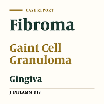 A case report of an extensive irritation fibroma on palatal margin of maxillary gingiva