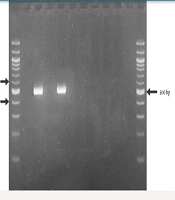 Challenges of Vancomycin Resistance in Methicillin-Resistant Staphylococcus aureus (MRSA) Among Patients with Complicated Diseases