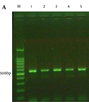 Preliminary Identification of Clinical Aspergillus flavus Isolates Using a Rapid β-Tubulin PCR–RFLP Method and Evaluation of Virulence Factors