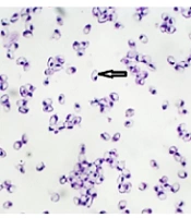Microscopic and Molecular Description of the Microsporidian Parasite, Heterosporis sp., Infecting Lizardfish, Saurida undosquamis in the Persian Gulf