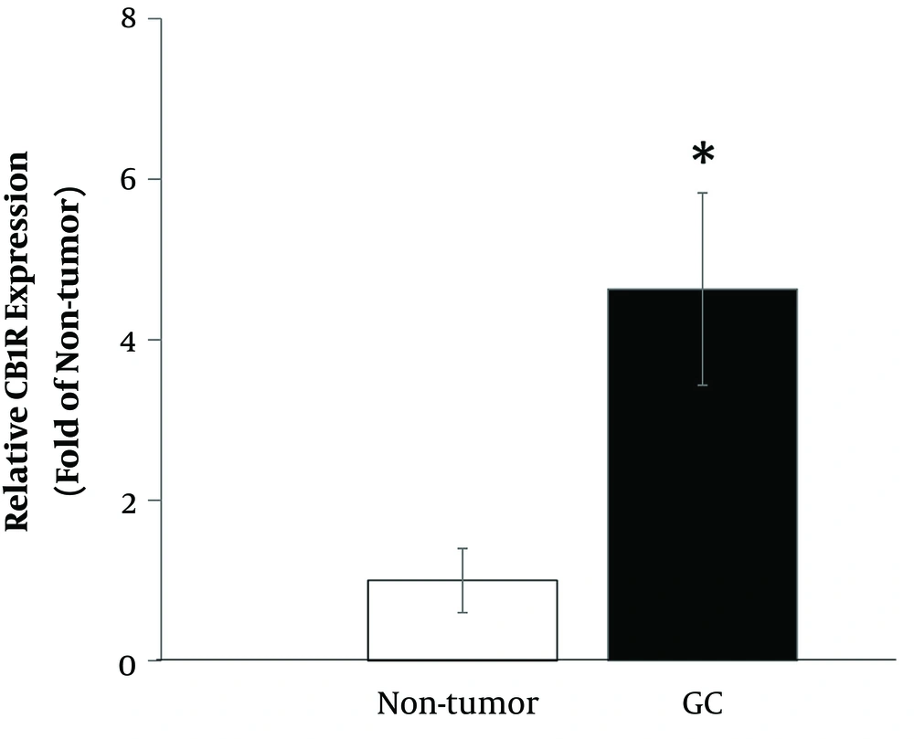 Relative expression of CB1R in gastric cancer tissues compared with normal adjacent tissues. *, P < 0.05. Relative expression of CB1R in gastric cancer tissues compared with normal adjacent tissues. *, P < 0.05.