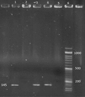 Genomic Investigation of Hepatitis E Virus in Persian Gazelle