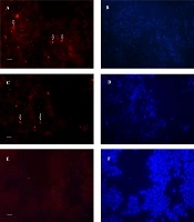 Biofilm Formation Capability of Clinical Helicobacter pylori Isolates on MKN-45 Cells