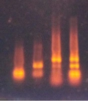 Antimicrobial Resistance Profile of Extended-spectrum Beta-lactamase Genes in Escherichia coli Isolates Using Multiplex PCR Technique