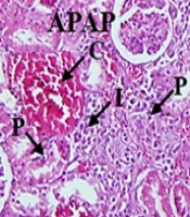 Ameliorating Effects of Silymarin-Loaded PLGA on Acetaminophen-Induced Nephrotoxicity in Mice