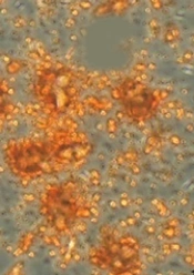 Adipose-Derived Mesenchymal Stem Cells Secretome Induces Apoptosis in Colon Carcinoma HT-29 Cells