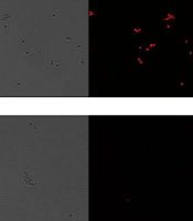 Cover image of the article: Alteration of Azole-Resistant Candida albicans Cell Permeability by a Flavonoid from Dalea elegans