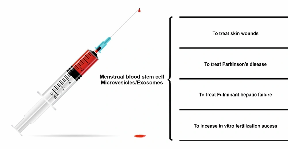 Schematic diagram of the applications of EVs caused by menstrual blood stem cells in treating different diseases Schematic diagram of the applications of EVs caused by menstrual blood stem cells in treating different diseases